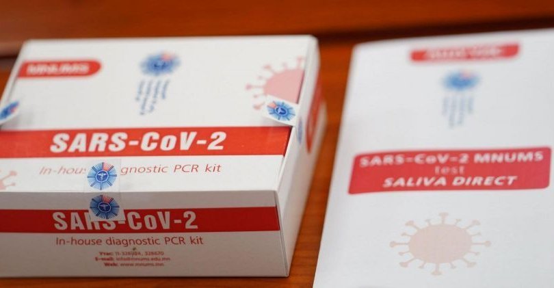 Монгол эрдэмтдийн бүтээсэн оношлуур 100 хувийн үр дүн үзүүлжээ